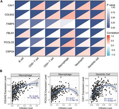 Gemcitabine-Resistant Biomarkers in Bladder Cancer are Associated with Tumor-Immune Microenvironment